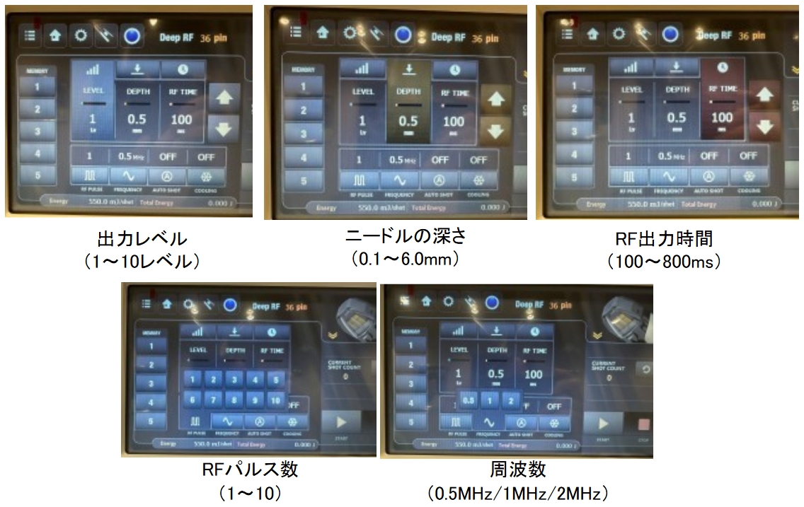 VIRTUE RF　２